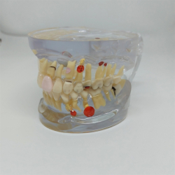 Transparent Sygdomsmodel